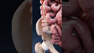Download lagu Diarrhea explained in 3D: what happens in your body during diarrhea? mp3 Download lagu Diarrhea explained in 3D: what happens in your body during diarrhea? mp3