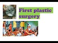 The First Plastic Surgery Sushruta Samhitha Book Of Surgery And Medicine Father Of Surgery