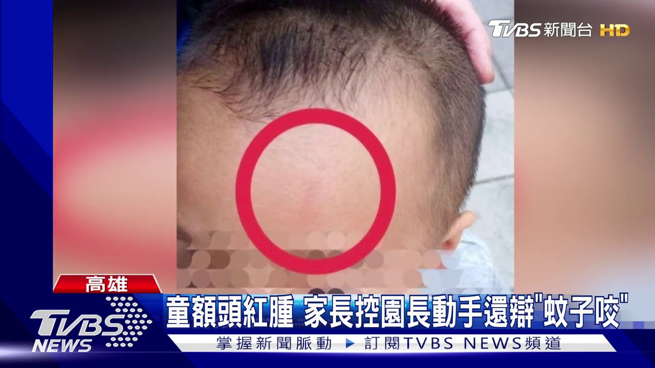 嫌太吵?園長拿紙捲打2歲童 園長:有輕拍