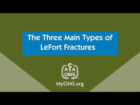 The Three Main Types of LeFort Fractures