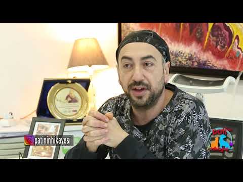 Patinin Hikayesi 83. Bölüm 3. Kısım