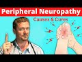 Peripheral NEUROPATHY (Causes and Cures) 2020 Peripheral NEUROPATHY (Causes and Cures) 2020