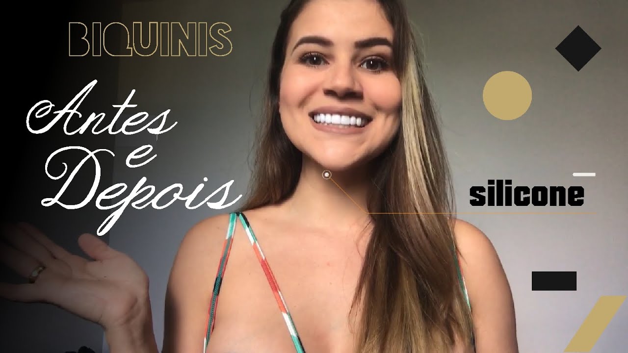 Watch Now Biquínis antes e depois do silicone - 400ml submuscular Biquínis antes e depois do silicone - 400ml submuscular