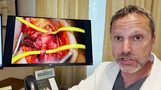 Dr. Lowenstein discusses occipital nerves