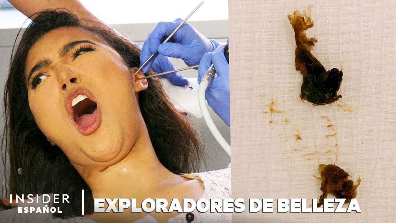 Cómo Se Extrae Profesionalmente La Cera De Los Oídos | Exploradores de Belleza | Insider Español
