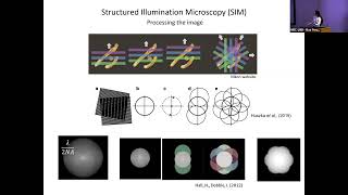 Super-Resolution Microscopy - Sarah Lecinski