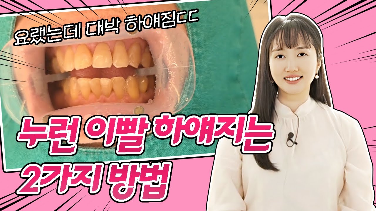 黃牙變白牙的方法！