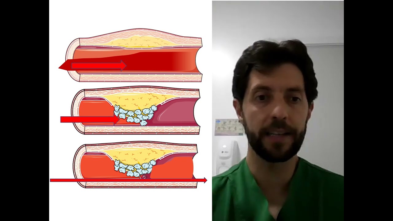 Fernando Bernardi-21