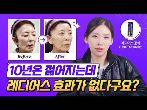 같은 레디어스 인데 누구는 10년 젊어지고, 누구는 티도 안날까요? 레디어스 시술 전후로 보는 효과, 유지기간 까지 꼭 알고 받으세요