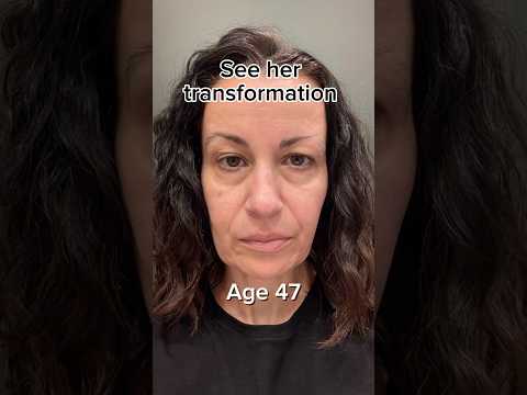 Facelift Naturally | Face Fitness | Face Yoga | Face Massage