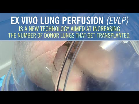 Ex Vivo Lung Perfusion Makes Donor Lungs Usable for ...