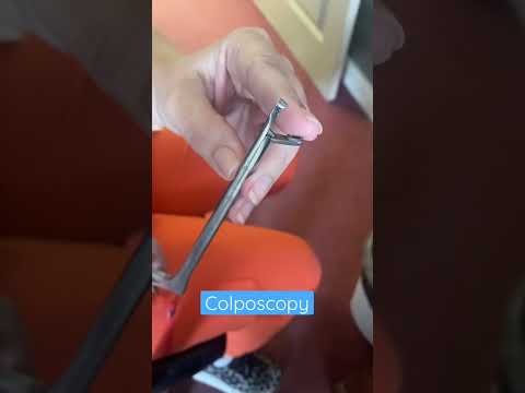 Colposcopy