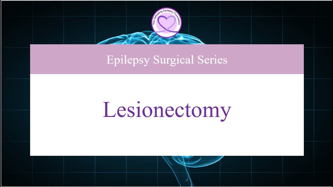 Unlocking the Secrets of Lesionectomy: What You Need to Know!