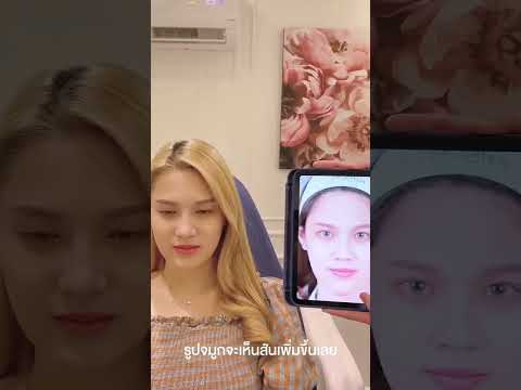 เสริมจมูกครั้งแรก มา 2 ปี ล่าสุด ประกวด Miss Tiffany แล้วจ้า ✨🔥 