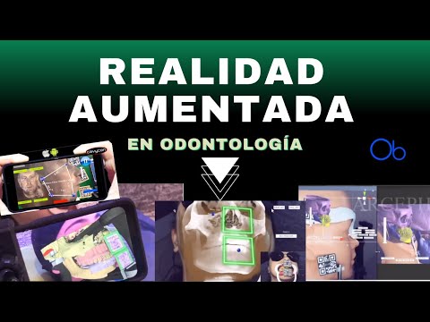 Realidad Aumentada en Odontología