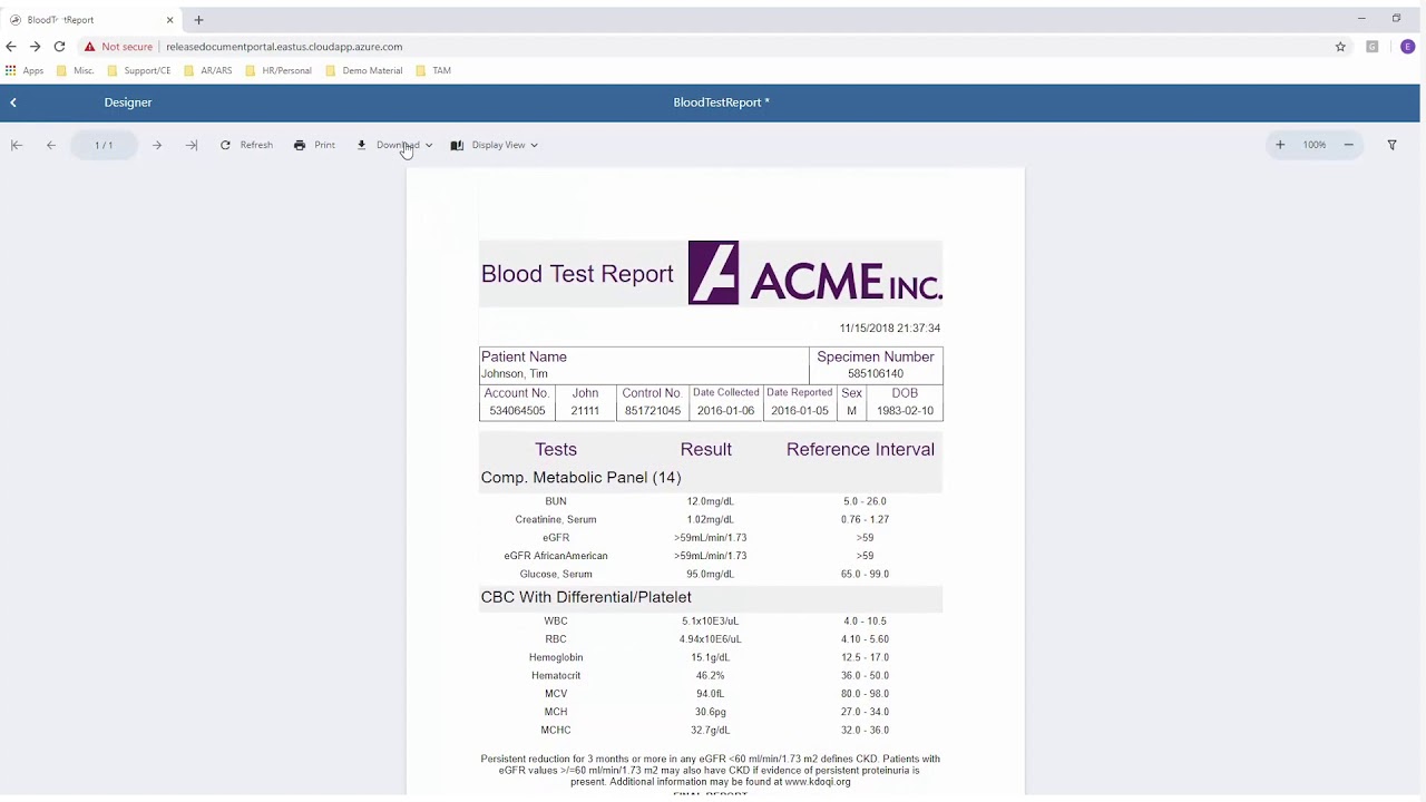 Introducing the JSViewer | ActiveReports