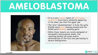 Ameloblastoma: Types, Clinical Features, Diagnosis, Differentials and Management