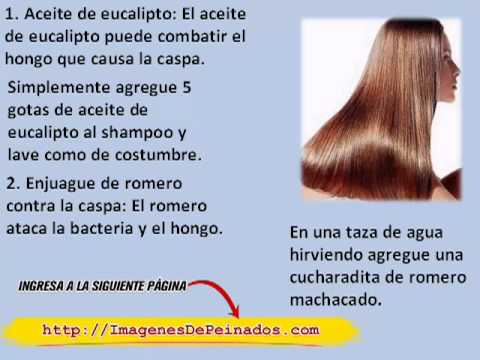 Como quitarme la caspa? Como quitarme la caspa?