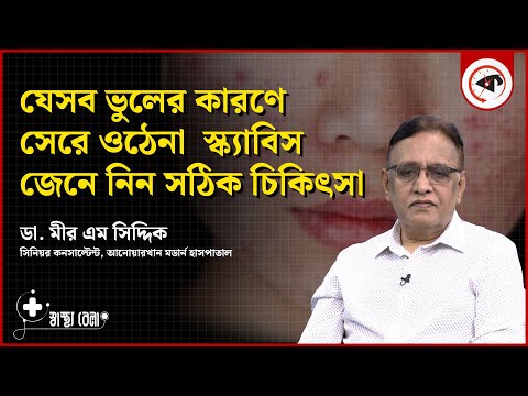 যেসব ভুলের কারণে সেরে ওঠেনা  স্ক্যাবিস, জেনে নিন সঠিক চিকিৎসা | Scabies Disease | Kalbela