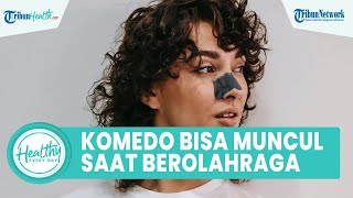 Tak Hanya di Hidung, Komedo Bisa Muncul di Badan Habis Berolahraga, Simak Ulasan dr Arini Widodo