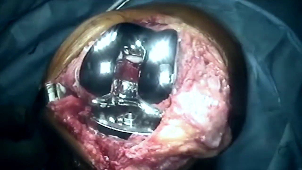 Ruperto Alfonso Muñoz Galguera-14