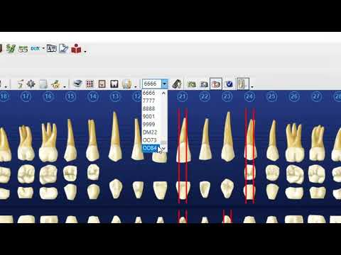 Dentrix Tutorial