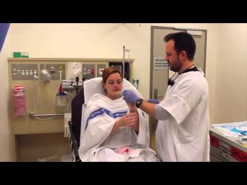 Epistaxis - Definitive Management