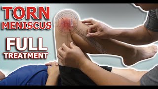 Decrease Knee Pain From Torn Meniscus | Treatment for Torn Meniscus by Expert Physical Therapist