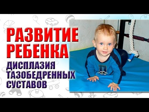 Как правильно спать на боку при остеохондрозе Гимнастика при болях в пояснице для женщин