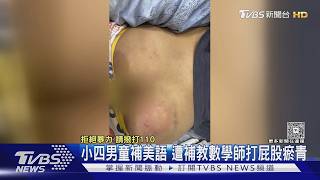 補英文卻被數學師抓去打!男童「屁股瘀青一片」家長淚崩提告