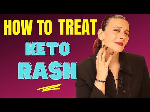 Keto Rash - How to Cure a Keto Rash!