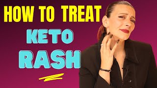 Keto Rash - How to Cure a Keto Rash!