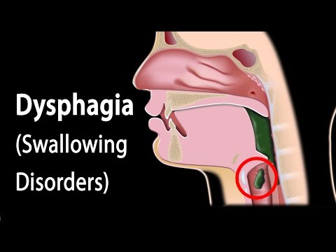 Dysphagia, Animation.