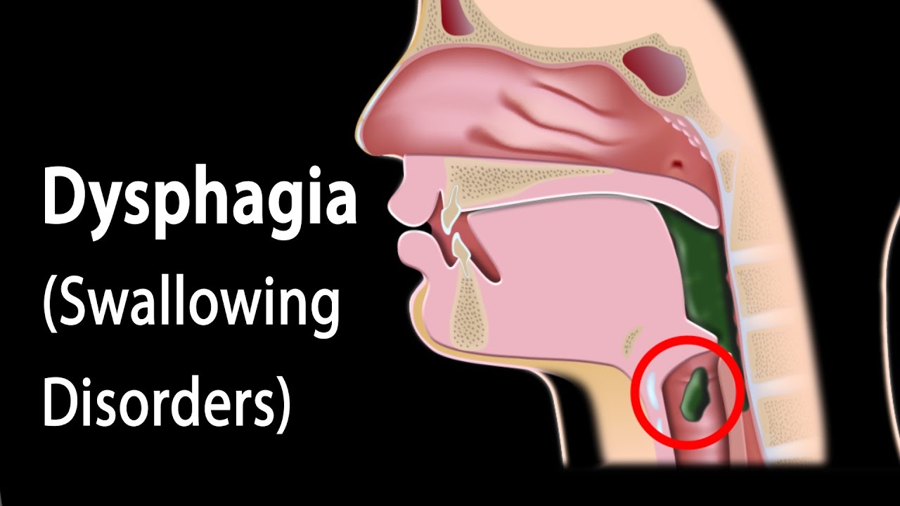 Dysphagia, Animation.