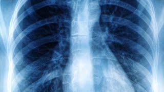 Cat de periculoase pot fi radiografiile?