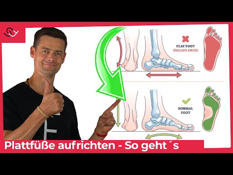 Plattfüße schnell ohne Einlagen loswerden - Mach diese Übung