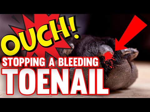 HOW TO Stop A Bleeding Toenail!