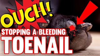 HOW TO Stop A Bleeding Toenail!