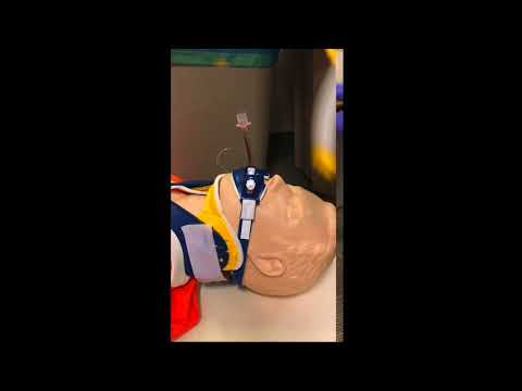 VVac Backup for ETT Suctioning