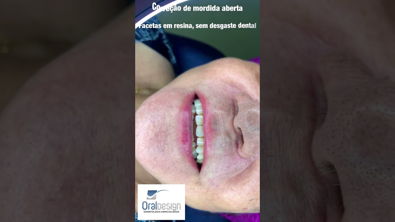 Danilo Monteiro Rezende Pereira-39