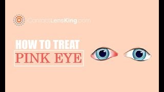 How to Treat Pink Eye (Conjunctivitis)