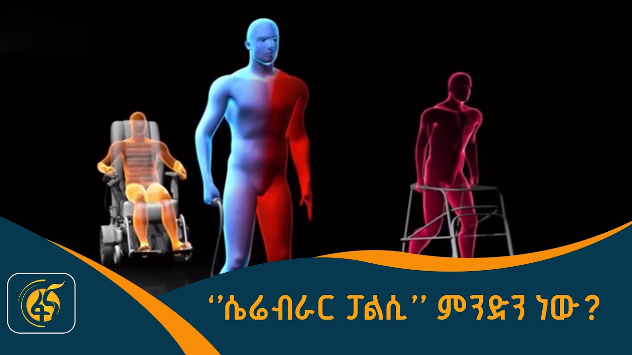 “የሴሬብራር ፓልሲ”መንስኤ እና ምልክቶች ምንድን ናቸው?