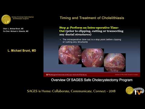 Overview of SAGES Safe Cholecystectomy Program from the SAGES Video Library