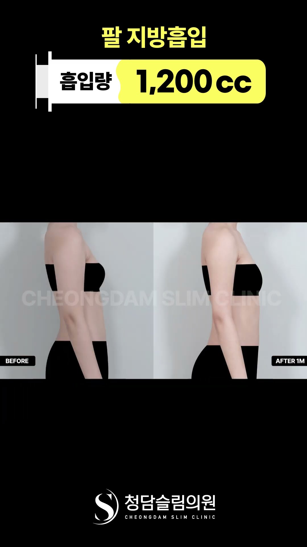 팔 라인 바뀌면 이런 느낌🧙‍♀️