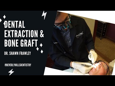 download lagu mp3 mp4 Beverly Grove Dentistry, download lagu Beverly Grove Dentistry gratis, unduh video klip Beverly Grove Dentistry