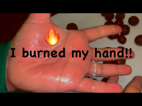 How to make chiniko dalla and I burned my hand😭😭#food #foodie