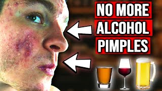 Why Does Alcohol Cause Acne? (HERE