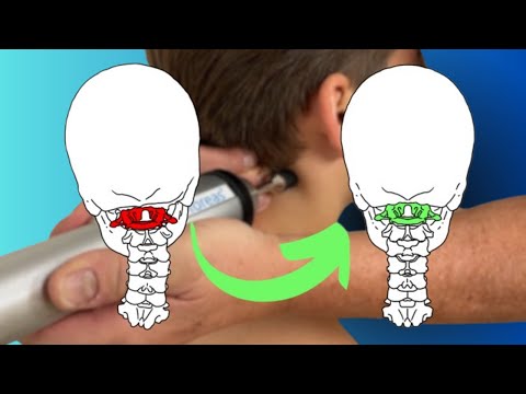 Wie DU deine Beschwerden endlich in den Griff bekommst!