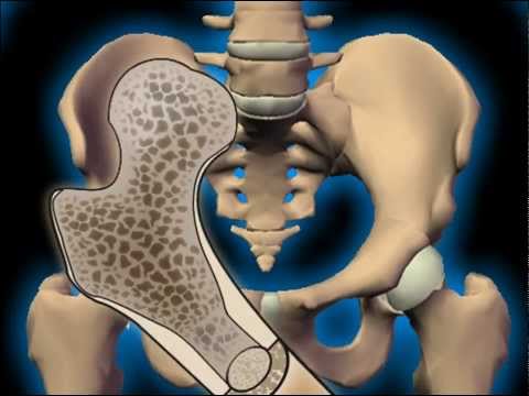 Prodotti lattiero-caseari articolazioni La diagnosi clinica articolazioni Doherty