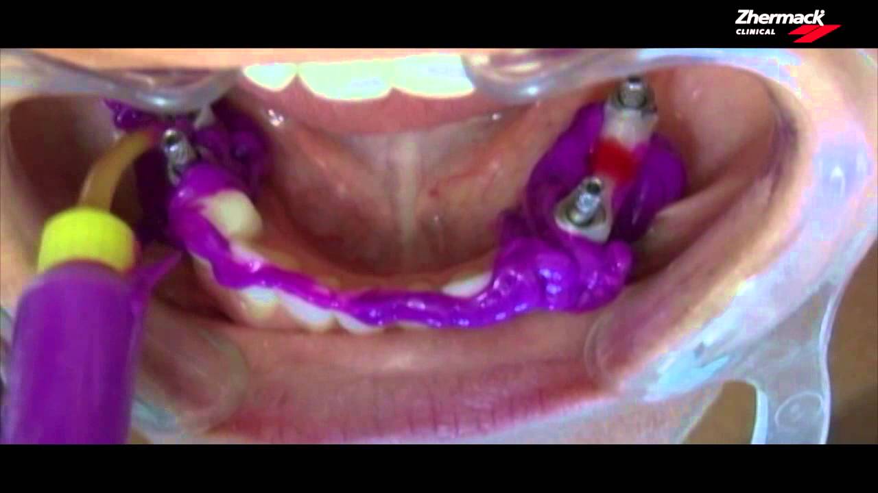 Hydrorise Video monophase (Espagnol)